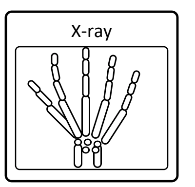Source X-ray picture of hand bones inside a frame with the X-ray label above